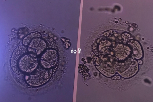 一般建议移植2天后再洗澡